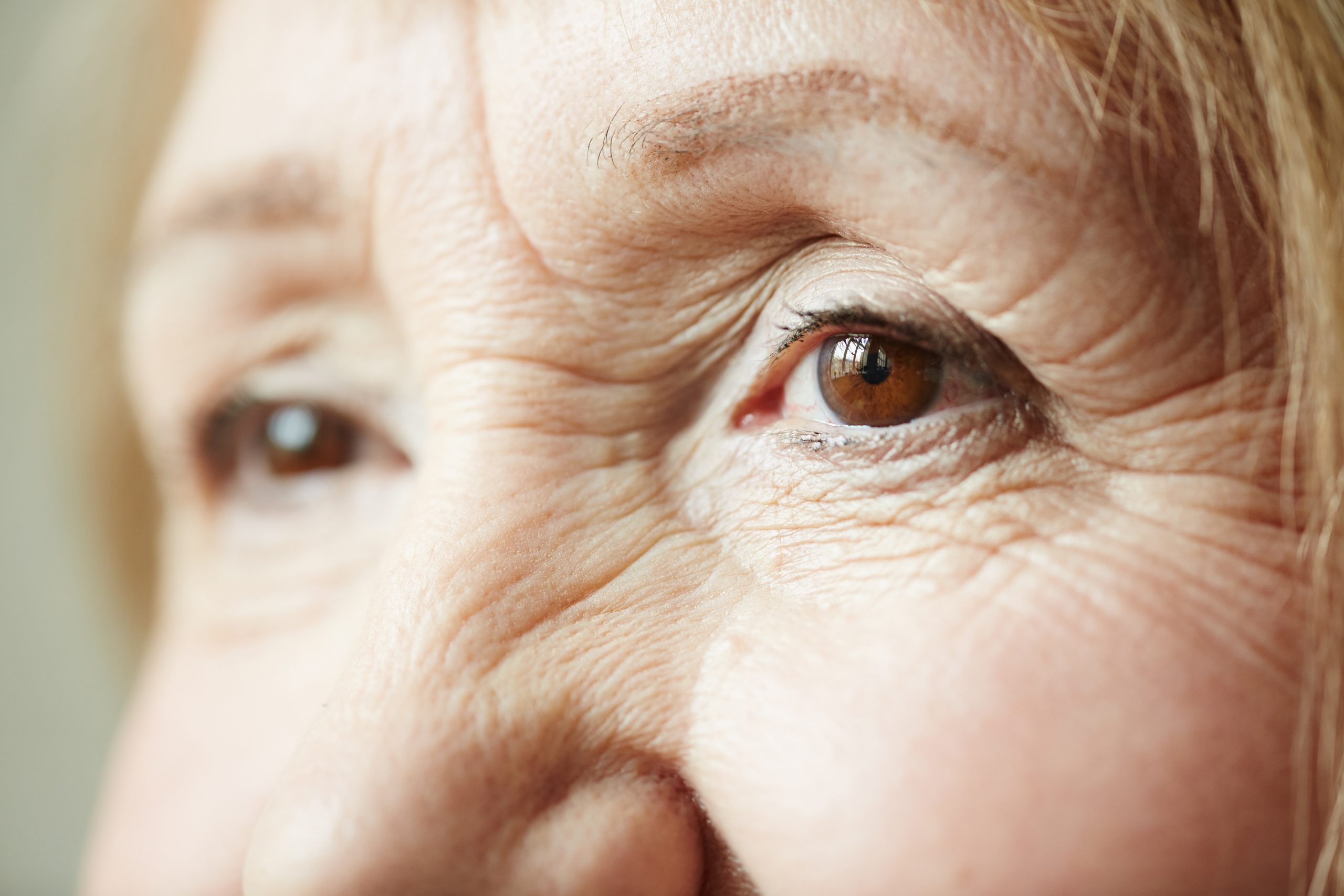 Cataratas: consejos para retrasar su aparición, según los oftalmólogos