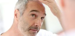 ¿La alopecia se puede frenar?