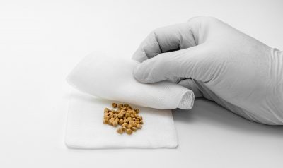 ¿Cómo se forman las piedras en la vejiga?