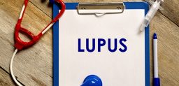 ¿Qué es el lupus y qué síntomas provoca?