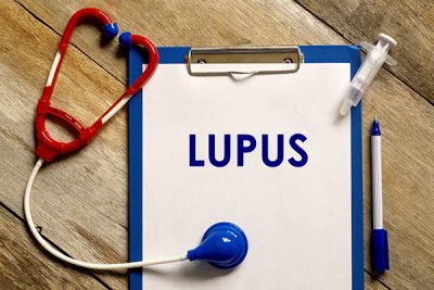 ¿Qué es el lupus y qué síntomas provoca?