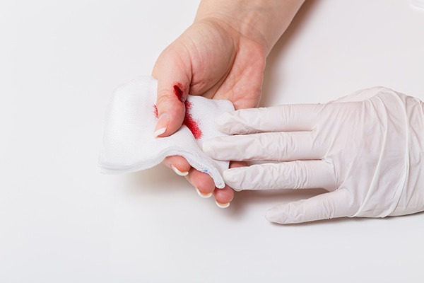 Ante una hemorragia externa, hay que aplicar gasas sobre la herida.