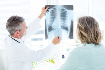 El cáncer de pulmón es uno de los más comunes. CinfaSalud