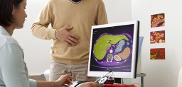 La enfermedad de Crohn puede afectar solo a unas zonas del intestino. CinfaSalud