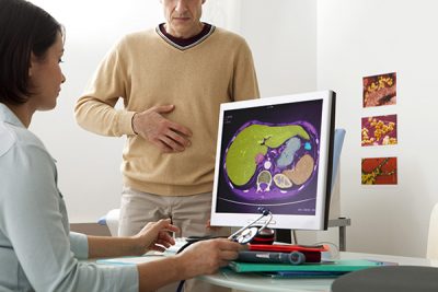 La enfermedad de Crohn puede afectar solo a unas zonas del intestino. CinfaSalud