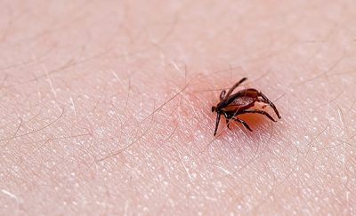¿Cómo es una picadura de garrapata? CinfaSalud