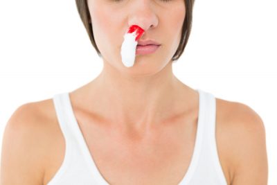 ¿Qué hacer ante una hemorragia nasal? CinfaSalud
