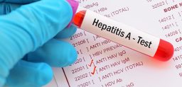 La hepatitis A no se convierte en una enfermedad crónica.