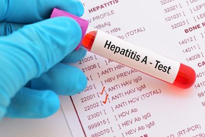 La hepatitis A no se convierte en una enfermedad crónica.