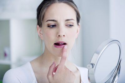 El virus del herpes labial continúa latente en el organismo. CinfaSalud