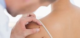 La exposición excesiva al sol es una de las causas de la aparición de melanoma. CinfaSalud