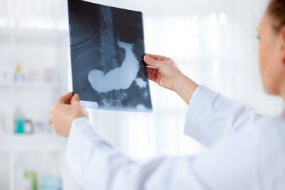 La inflamación del páncreas es una patología potencialmente grave. CinfaSalud