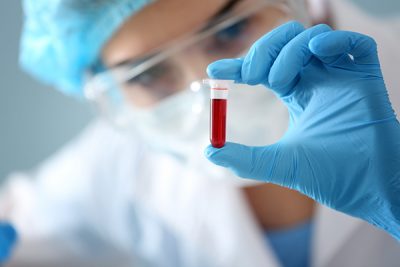 La anemia puede ser el síntoma de alguna otra patología más grave.. CinfaSalud