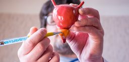 El agrandamiento de la próstata no es un cáncer de próstata.