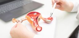 El cáncer de endometrio es uno de los tumores ginecológicos más frecuentes.