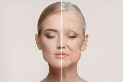 Los principales síntomas del fotoenvejecimiento se observan en zonas como el rostro.