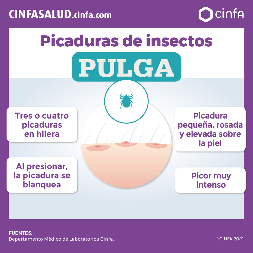 Cómo prevenir la picadura pulga? CinfaSalud