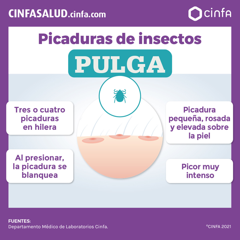  C mo Prevenir La Picadura De Pulga CinfaSalud