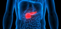 El cáncer de páncreas presenta una elevada mortalidad.