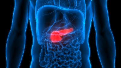 El cáncer de páncreas presenta una elevada mortalidad.