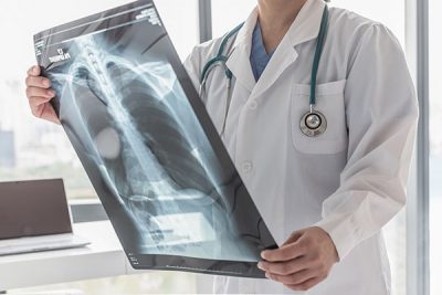 Un neumotórax es siempre una urgencia médica.