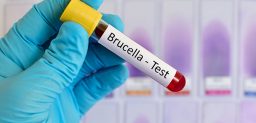 La brucelosis es una infección causada por especies de bacterias del género Brucella.