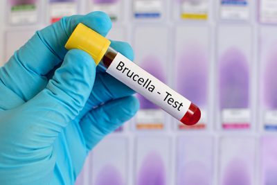 La brucelosis es una infección causada por especies de bacterias del género Brucella.