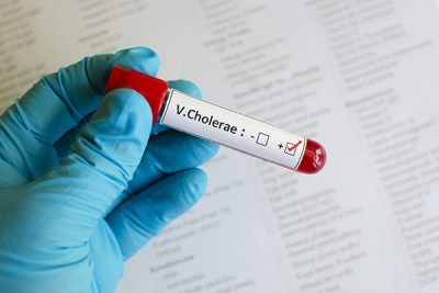 El cólera es una enfermedad intestinal aguda causada por la ingestión de alimentos contaminados.