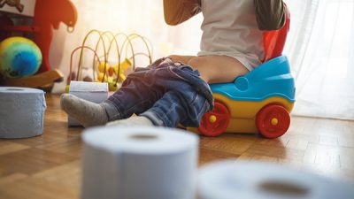 El estreñimiento en niños es una consulta muy frecuente en atención primaria.