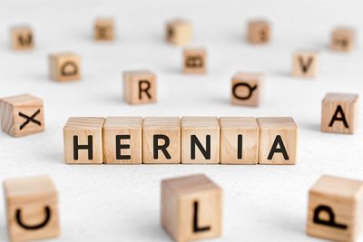 La hernia de hiato se produce por el paso anormal del estómago al tórax.
