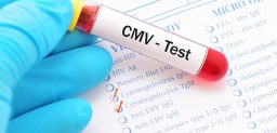 El citomegalovirus es un virus de la familia de los herpesvirus