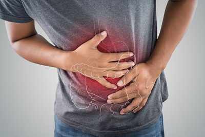 La diverticulitis es la inflamación de los divertículos, unas bolsas en forma de sacos que se forman en la pared interior del tubo digestivo.