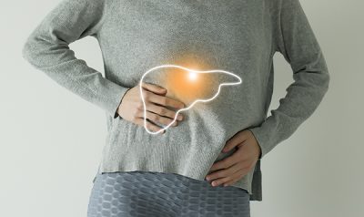 La enfermedad de hígado graso no alcohólica engloba una serie de afecciones hepáticas en personas que toman poco o nada de alcohol.