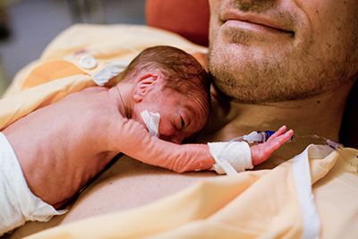La mayoría de los bebés nacidos después de las 27 semanas de gestación sobreviven con una funcionalidad neurológica normal.