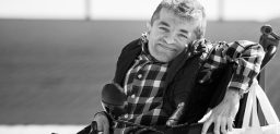 La osteogénesis imperfecta (OI) es una displasia esquelética hereditaria causada por una anomalía en la síntesis o procesamiento del colágeno tipo I