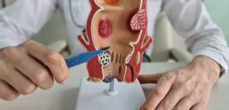 El origen de una fístula suele ser la infección de una de las glándulas situadas entre el ano y el recto