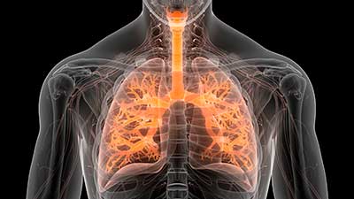 Los signos y los síntomas de la fibrosis pulmonar idiopática aparecen en el transcurso de 6 meses hasta varios años.