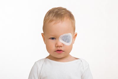 La ambliopía, conocida popularmente como “ojo vago”, es una patología que se origina en la infancia.