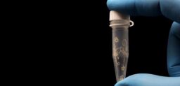 Las parasitosis pueden producirse por la ingestión de quistes de protozoos o de huevos o larvas de gusanos, así como por la penetración de larvas a través de la piel.