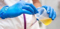 En las infecciones de orina, el agente infeccioso más habitual es la bacteria Escherichia coli.
