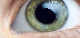 El agujero macular se define por la formación de una abertura circular en la mácula, que es la región central de la retina.