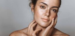 Las pecas o efélides son pequeñas pigmentaciones marrones de melanina que aparecen en las zonas del cuerpo más expuestas a las radiaciones del sol, sobre todo en la cara, el pecho, los brazos y los hombros.