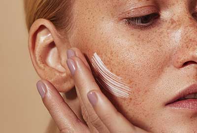 Las efélides son consecuencia de una mayor producción de melanina, el pigmento que da color a la piel, el cabello y los ojos.