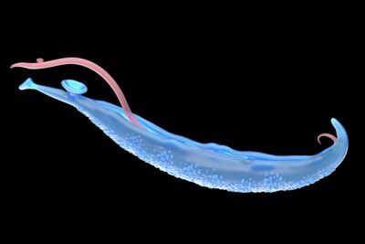 La esquistosomiasis es conocida también como bilharziasis