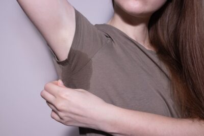 La hiperhidrosis es la producción excesiva y constante de sudor por parte de las glándulas ecrinas.