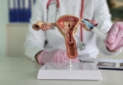 la prevalencia mundial de la vaginosis bacteriana en mujeres en edad fértil oscila entre el 23% y el 29%.