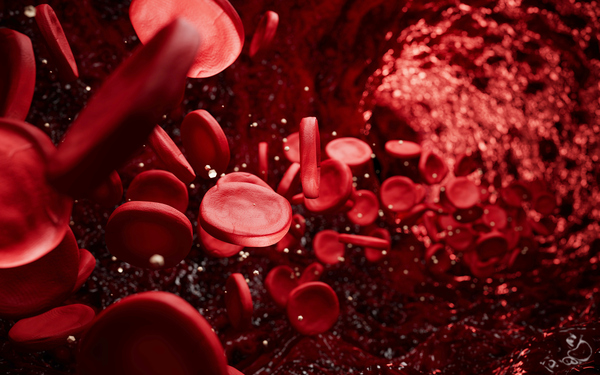 La anemia perniciosa es el déficit de glóbulos rojos que se produce cuando el intestino no es capaz de absorber correctamente la vitamina B12. 